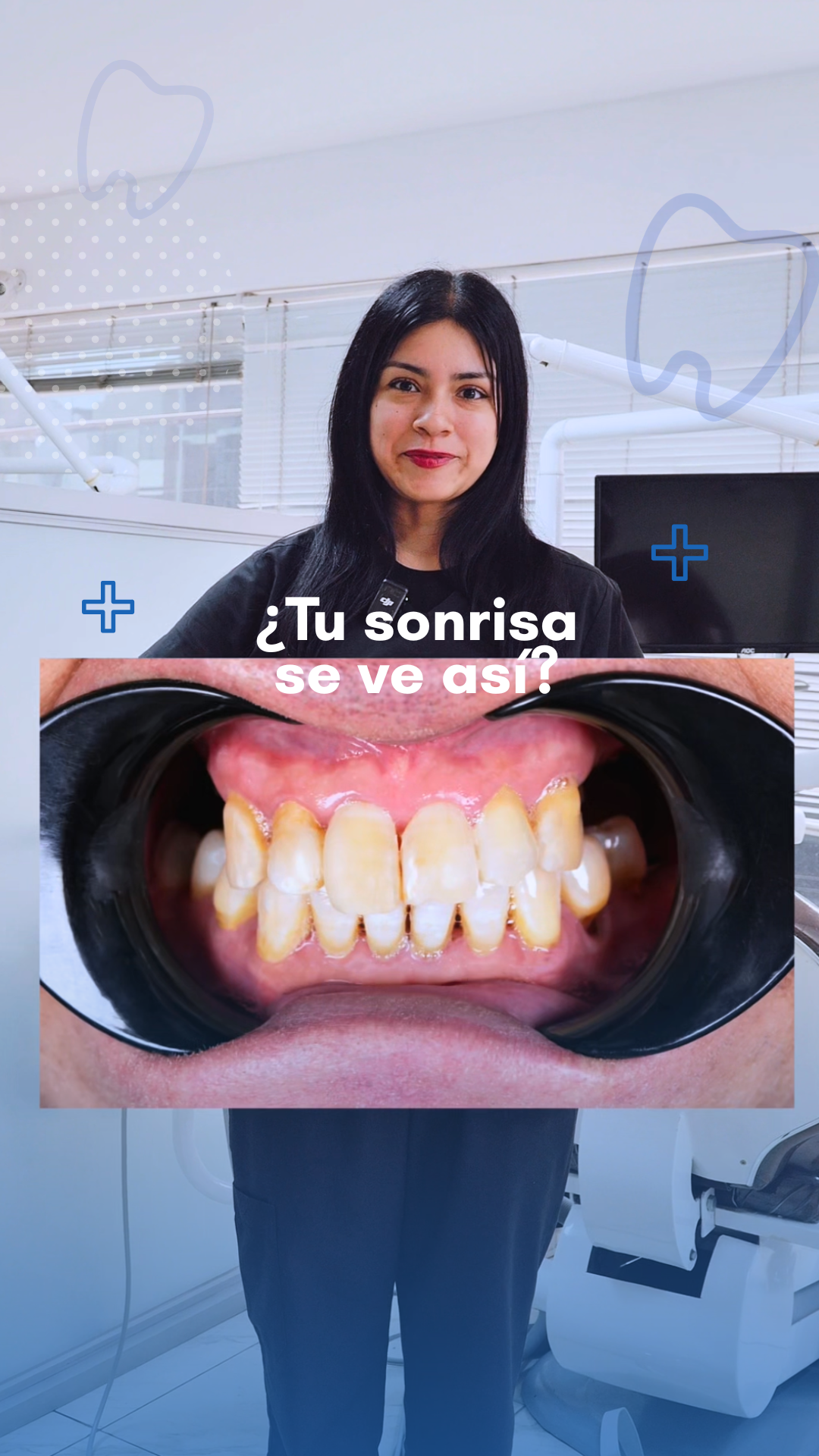 Portada Sonrisa Imparable.png